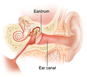 Swimmer’s ear is an irritation and infection of the ear canal. Cross section of child's ear showing outer, inner, and middle ear structures.