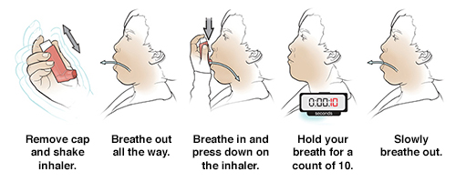 Discharge Instructions: Using a Metered-Dose Inhaler - Sterling Care