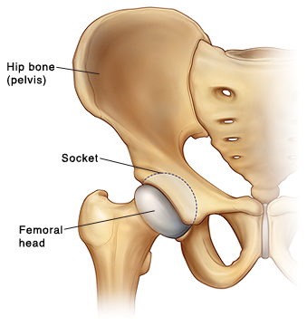 Treating Arthritis In Young Dogs Treating Arthritis In Young Dogs