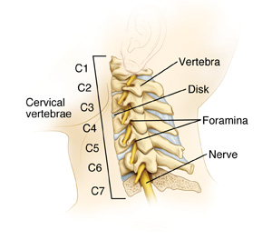 Cervical Spine Problems: Disk - Sterling Care - In-Home Care