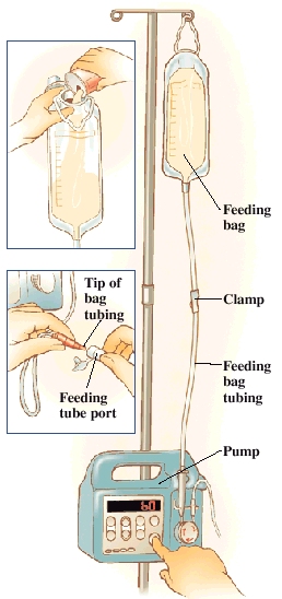 Feeding Formula At Room Temperature Feeding Formula At Room Temperature
