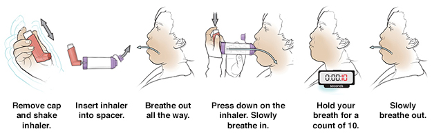 Metered dose inhaler sample