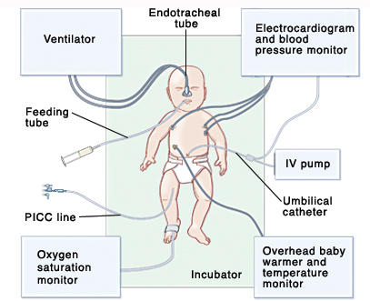 Equipment in the NICU - Sterling Care - In-Home Care 